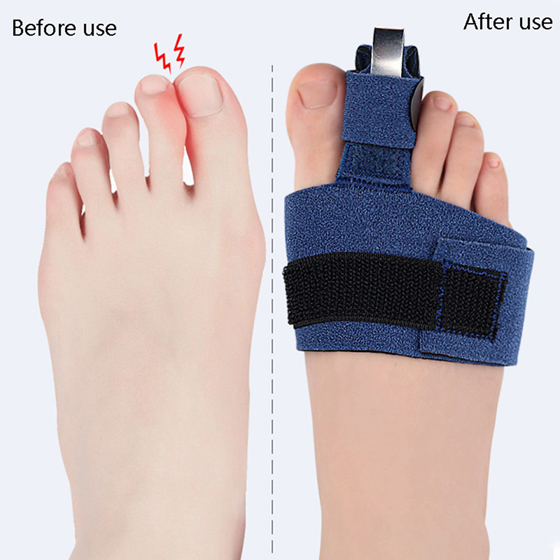 1 szt. Korektor palców, orteza – Ankle Brace Sock recenzja i cena